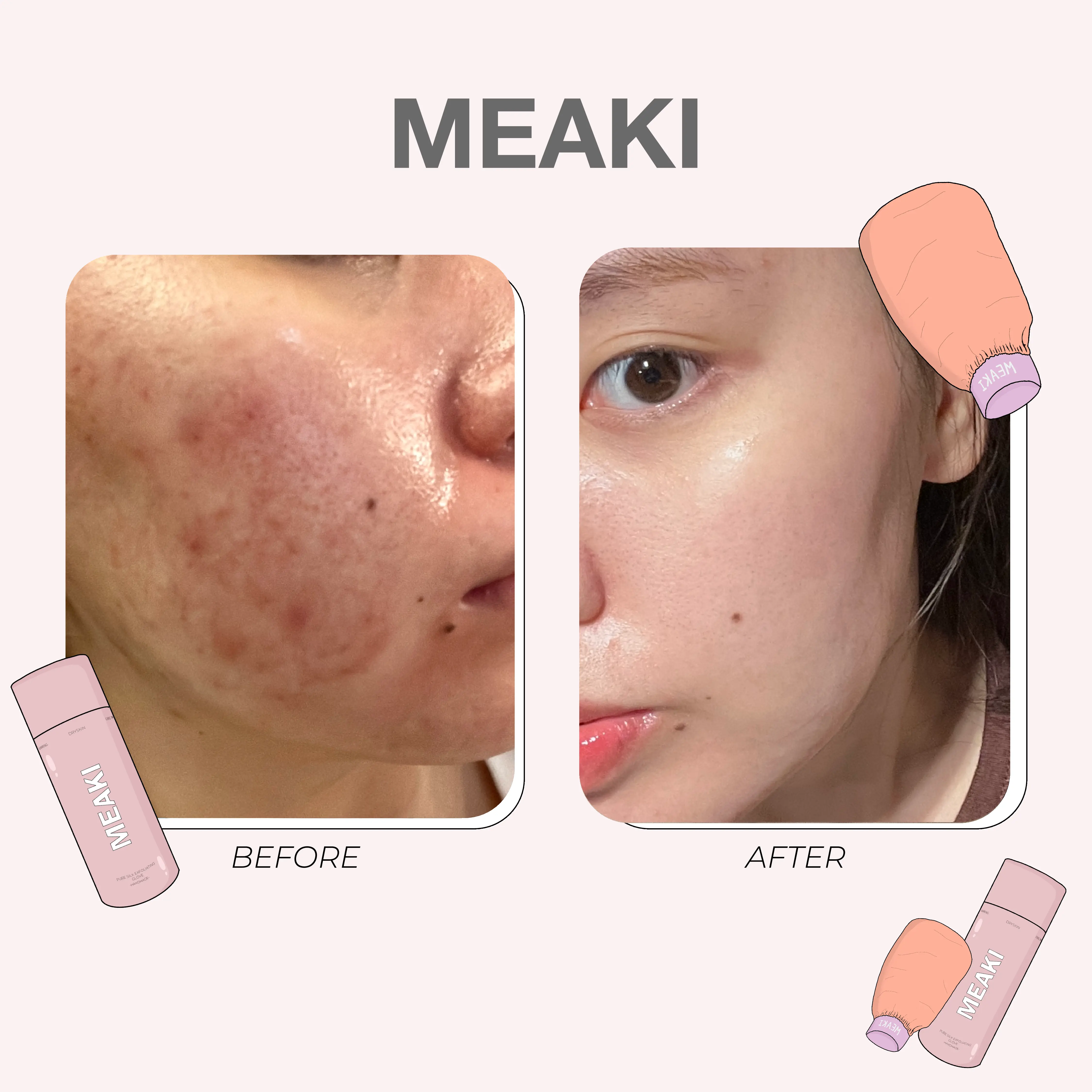 meaki-feedback
