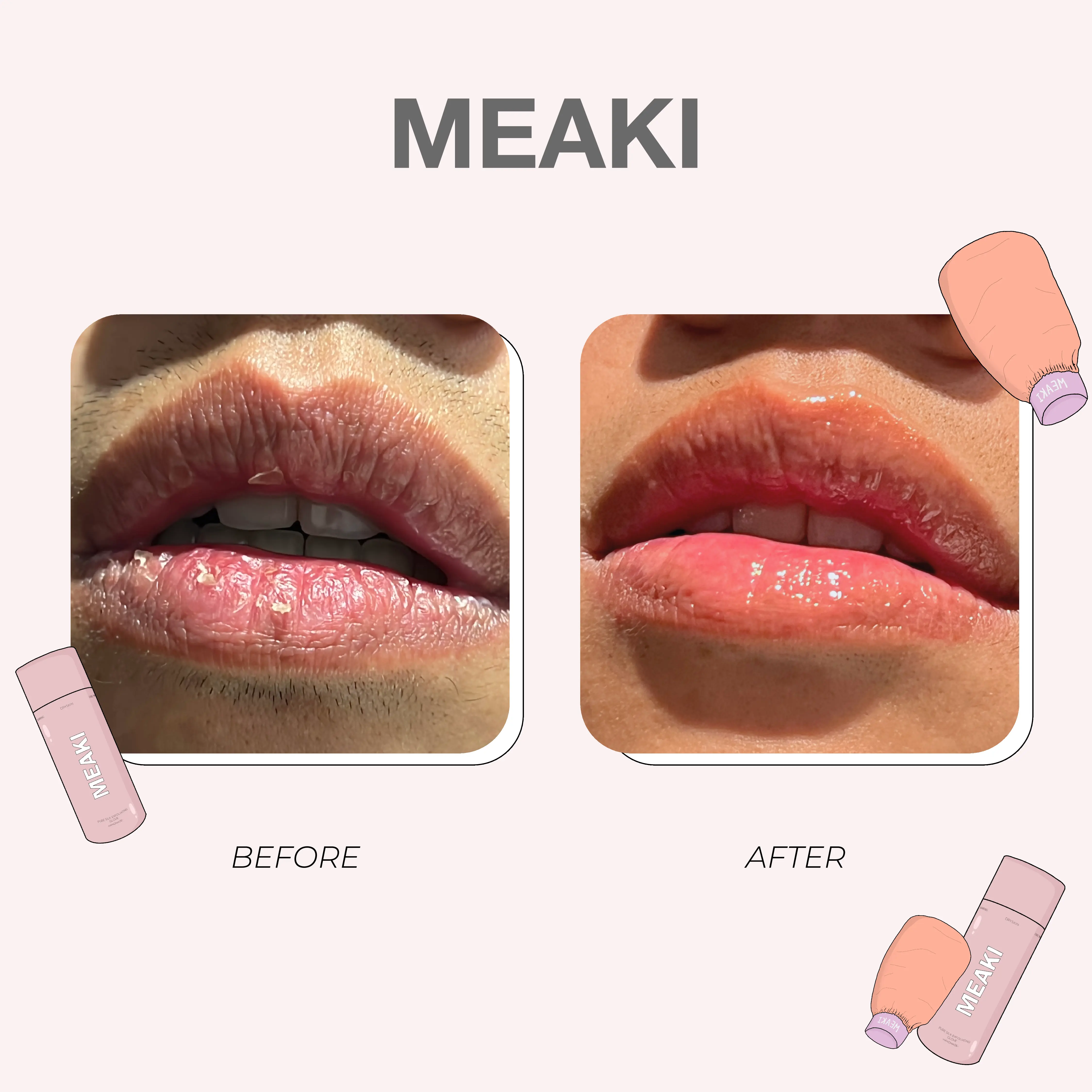 meaki-feedback